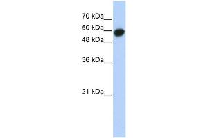 WB Suggested Anti-LRRC6 Antibody Titration: 0. (LRRC6 antibody  (Middle Region))