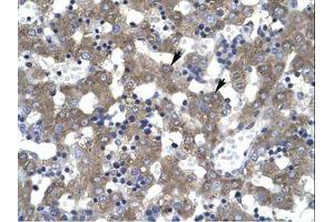 Image no. 1 for anti-Dachshund 2 (DACH2) (AA 525-574) antibody (ABIN6735937) (DACH2 antibody  (AA 525-574))