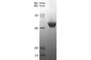 Validation with Western Blot (Coxsackie Adenovirus Receptor Protein (His tag))
