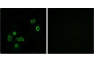 Immunofluorescence analysis of A549 cells, using BRP44L Antibody. (BRP44L antibody  (AA 11-60))