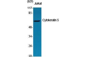 Western Blot (WB) analysis of specific cells using Cytokeratin 5 Polyclonal Antibody. (Cytokeratin 5 antibody  (C-Term))