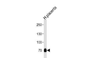 Western blot analysis of lysate from human placenta tissue lysate, using NEK11L Antibody  (ABIN392646 and ABIN2842148). (NEK11 antibody  (C-Term))