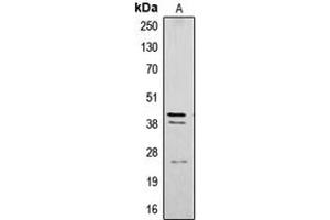 Western blot analysis of Cathepsin B expression in SW480 (A) whole cell lysates.