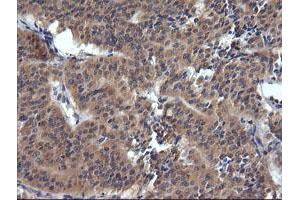 Image no. 2 for anti-Tripartite Motif Containing 38 (TRIM38) (AA 1-265) antibody (ABIN1490680) (TRIM38 antibody  (AA 1-265))