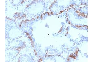 Immunohistochemistry (IHC) image for anti-Keratin 6A (KRT6A) antibody (ABIN6939867)