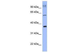KCTD4 antibody used at 1 ug/ml to detect target protein. (KCTD4 antibody  (N-Term))