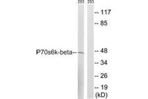 Western blot analysis of extracts from 293 cells, using p70 S6 Kinase beta (Ab-423) Antibody.