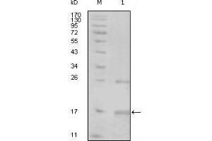 Western blot analysis using TNK1 mouse mAb against truncated TNK1-His recombinant protein (1). (TNK1 antibody  (AA 451-560))