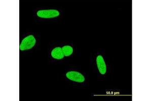 Image no. 1 for anti-Integrator Complex Subunit 6 (INTS6) (AA 779-888) antibody (ABIN599210) (INTS6 antibody  (AA 779-888))