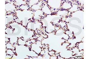 Formalin-fixed and paraffin embedded rat lung labeled with Anti-SP-D PSPD Polyclonal Antibody, unconjugated (ABIN731678) at 1:200, followed by incubation with conjugated secondary antibody and DAB staining. (SFTPD antibody  (AA 301-375))