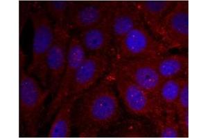 Image no. 2 for anti-Synuclein, alpha (SNCA) (pTyr136) antibody (ABIN401577)