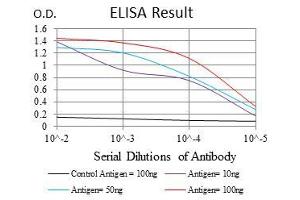 Black line: Control Antigen (100 ng), Purple line: Antigen(10 ng), Blue line: Antigen (50 ng), Red line: Antigen (100 ng), (PPP1CA antibody)