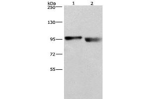 Western Blot analysis of A431 and lovo cell using KIAA1524 Polyclonal Antibody at dilution of 1:597 (KIAA1524 antibody)