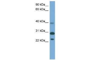 WB Suggested Anti-CCDC28A Antibody Titration: 0. (CCDC28A antibody  (Middle Region))