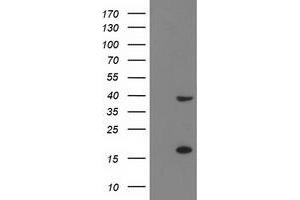 Western Blotting (WB) image for anti-PDZ and LIM Domain 2 (PDLIM2) antibody (ABIN1500125) (PDLIM2 antibody)