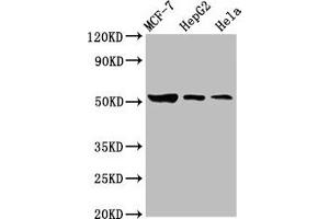 Western Blot Positive WB detected in: MCF-7 whole cell lysate, HepG2 whole cell lysate, Hela whole cell lysate All lanes: GBA antibody at 3.