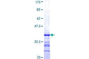 Inversin Protein (INVS) (AA 1-91) (GST tag)