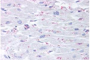 Anti-CYSLTR2 / CYSLT2 antibody  ABIN1048490 IHC staining of human heart. (CasLTR2 antibody  (C-Term))