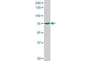FBXW7 polyclonal antibody (A01), Lot # 051026JC01 Western Blot analysis of FBXW7 expression in Jurkat . (FBXW7 antibody  (AA 599-707))
