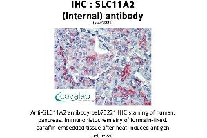 Image no. 2 for anti-Solute Carrier Family 11 (Proton-Coupled Divalent Metal Ion Transporters), Member 2 (SLC11A2) (Internal Region) antibody (ABIN1739323) (SLC11A2 antibody  (Internal Region))