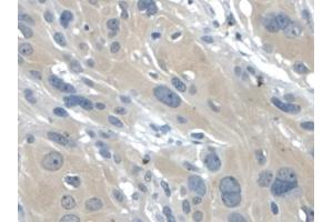 IHC-P analysis of Human Esophagus, with DAB staining. (Galectin 2 antibody  (AA 1-132))