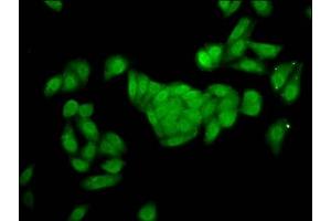 Immunofluorescence staining of HepG2 cells with ABIN7153203 at 1:166, counter-stained with DAPI. (FBP2 antibody  (AA 283-339))