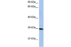 WB Suggested Anti-CRYBA1 Antibody Titration: 0.