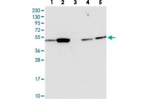 Western blot analysis of Lane 1: RT-4, Lane 2: U-251 MG, Lane 3: Human Plasma, Lane 4: Liver, Lane 5: Tonsil with ATF7IP2 polyclonal antibody  at 1:250-1:500 dilution. (ATF7IP2 antibody)