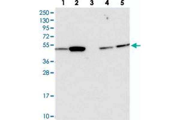 ATF7IP2 antibody
