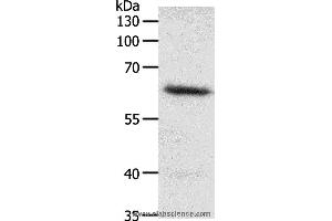 Western blot analysis of Mouse heart tissue, using FZD4 Polyclonal Antibody at dilution of 1:200