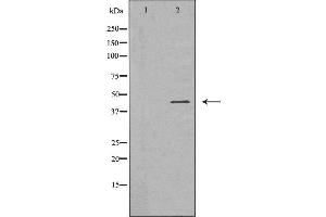 Western blot analysis of U937 cell lysate, using FCGR1A Antibody. (FCGR1A antibody  (Internal Region))