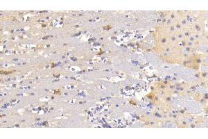 Immunohistochemistry (IHC) image for anti-Microtubule-Associated Protein 1B (MAP1B) (AA 2203-2464) antibody (ABIN7444907)