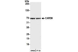 anti-Caspase Recruitment Domain Family, Member 9 (CARD9) (AA 450-500) antibody