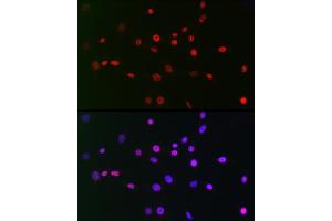 Immunofluorescence analysis of NIH/3T3 cells using CTBP2 Rabbit mAb (ABIN7265979) at dilution of 1:100 (40x lens).