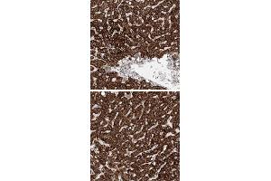 Immunohistochemical staining of human liver with PKHD1 polyclonal antibody  shows strong cytoplasmic positivity in hepatocytes.