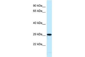 Host:  Rabbit  Target Name:  Nfic  Sample Type:  Mouse Heart lysates  Antibody Dilution:  1. (NFIC antibody  (N-Term))