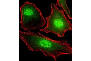 Fluorescent image of Hela cells stained with FUBP3 Antibody (N-term) B.