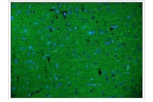 IF analysis of Alpha Internexin/INA using anti-Alpha Internexin/INA antibody (ABIN7602187).