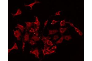 ABIN6267406 staining Hela by IF/ICC. (Stathmin 1 antibody  (pSer38))