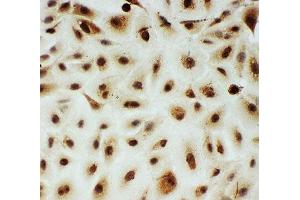 Immunocytochemistry (ICC) image for anti-V-Myb Myeloblastosis Viral Oncogene Homolog (Avian)-Like 2 (MYBL2) (N-Term) antibody (ABIN3029533)