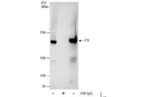 IP Image Immunoprecipitation of C3 protein from HepG2 whole cell extracts using 5 μg of C3 antibody [C3], C-term, Western blot analysis was performed using C3 antibody [C3], C-term, EasyBlot anti-Rabbit IgG  was used as a secondary reagent. (C3 antibody  (C-Term))