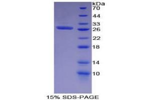 SDS-PAGE analysis of Mouse EGFR2 Protein. (EGFR2 Protein)