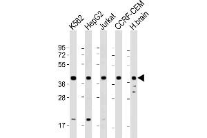 Western Blot at 1:2000 dilution Lane 1: K562 whole cell lysate Lane 2: HepG2 whole cell lysate Lane 3: Jurkat whole cell lysate Lane 4: CCRF-CEM whole cell lysate Lane 5: human brain lysate Lysates/proteins at 20 ug per lane. (PPID antibody  (AA 336-370))