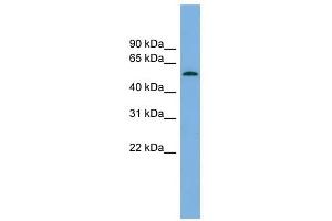 GLCCI1 antibody used at 1 ug/ml to detect target protein. (GLCCI1 antibody  (Middle Region))