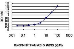 Detection limit for recombinant GST tagged RAD18 is approximately 0. (RAD18 antibody  (AA 332-430))