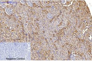 Immunohistochemical analysis of paraffin-embedded rat kidney tissue. (MAP1LC3A antibody)