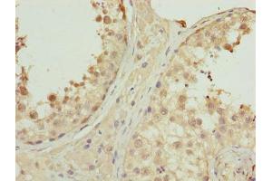 Immunohistochemistry of paraffin-embedded human testis tissue using ABIN7162623 at dilution of 1:100 (PNMA1 antibody  (AA 151-353))