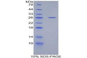 SDS-PAGE (SDS) image for CD200 (CD200) (AA 31-232) protein (His tag) (ABIN2124374)