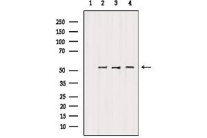 Western blot analysis of extracts from various samples, using FAF2 Antibody.