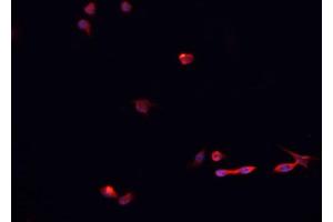 Immunofluorescence (fixed cells) (IF/ICC) image for anti-Small Ubiquitin Related Modifier Protein 1 (SUMO1) (N-Term) antibody (ABIN6265373)